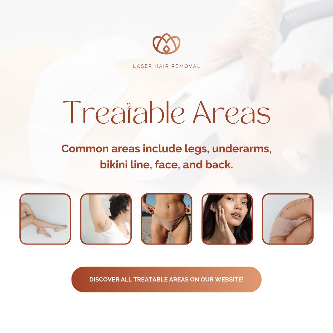 Laser Hair Removal Templates | Beauty and Aesthetics | Social Media Planner, Analytics Guide and 800 Faceless Videos - Social Canvas