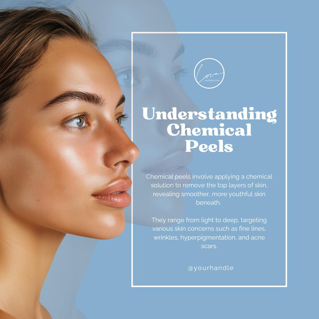 30 Chemical Peel Social Media Templates | Skincare Marketing Canva Pack for Estheticians & Med Spas | Social Media Planner, Analytics Guide - Social Canvas